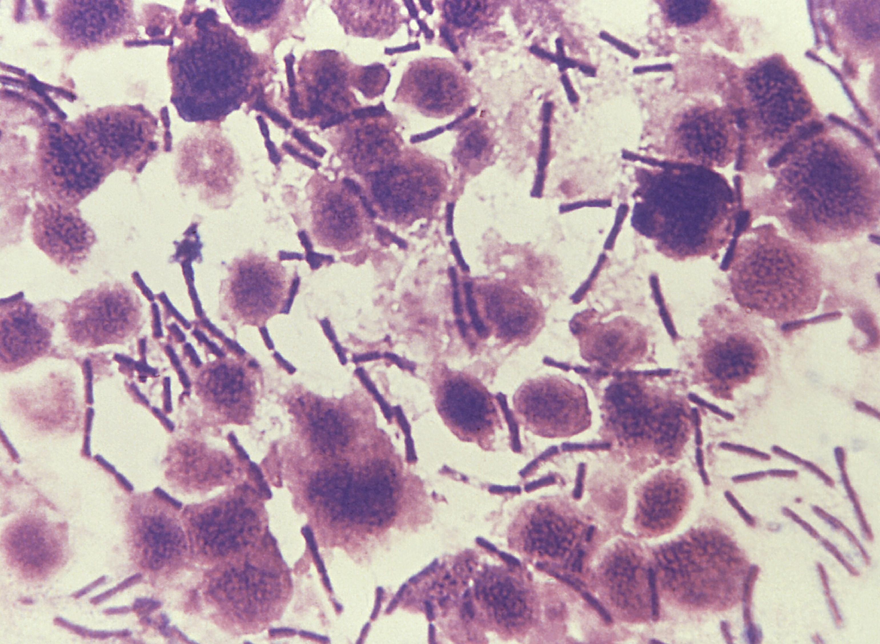 Sibīrijas mēris ir sevišķi bīstama, nāvējoša slimība, ko ierosina sporas veidojošā baktērija Bacillus anthracis. Sabiedrībā Sibīrijas mēris ir pazīstams arī kā Sibīrijas lopu mēris un liesassērga.