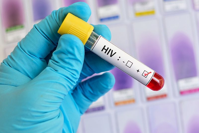 Latvijā HIV inficēto īpatsvars sabiedrībā ir augstākais visā Eiropas Savienībā, liecina statistika.