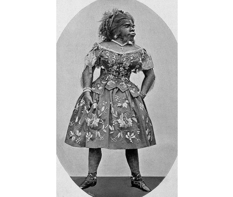 Jūlija Pastrana (1834–1860).
