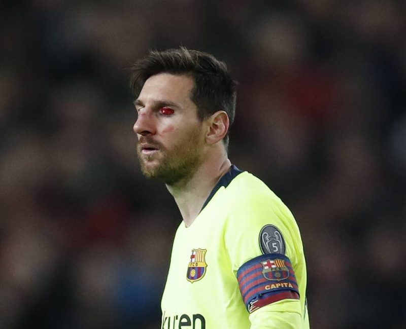 Lionels Mesi spēlē pret Mančestras “United” diezgan pamatīgi cieta, taču maču pabeidza.