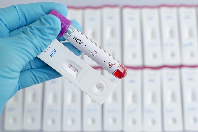 Par C hepatītu var liecināt palielināts aknu fermenta aspartātaminotransferāzes – ALAT, līmenis asinis.